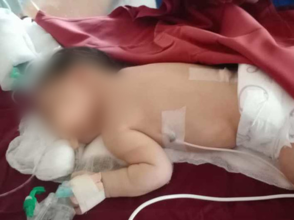 Help This 5 Days Old Fight Meconium Aspiration Syndrome