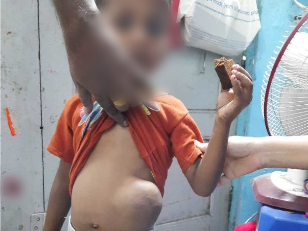 Support Kartik Halgi Recover From Stomach Cancer