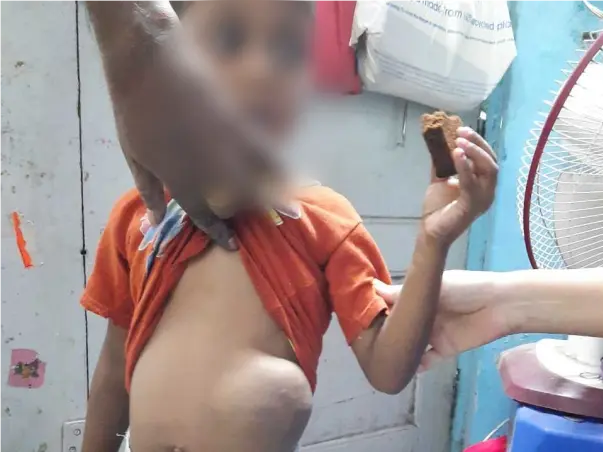 Support Kartik Halgi Recover From Stomach Cancer