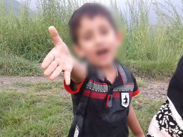 5 Years Old Ahil
 Needs Your Help to Fight Ewing's Sarcoma