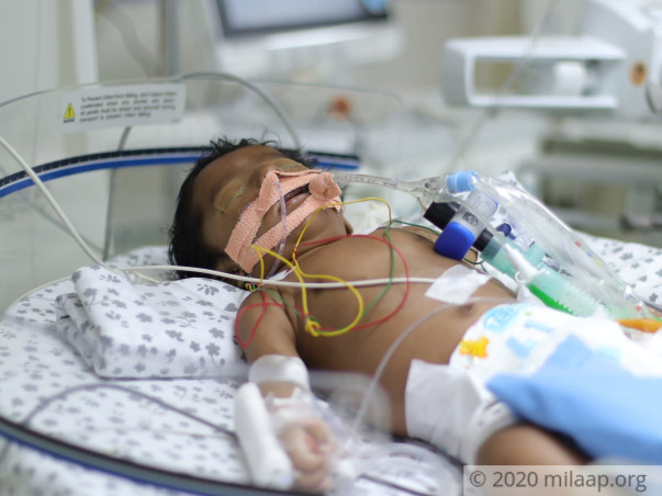 It's Been Nearly 2 Weeks Since This Newborn Opened His Eyes