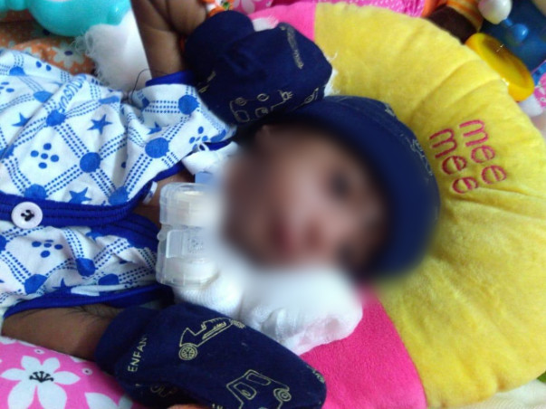 This 1 Month Old Needs Your Urgent Support In Fighting Atrial Septal Defect (Asd)