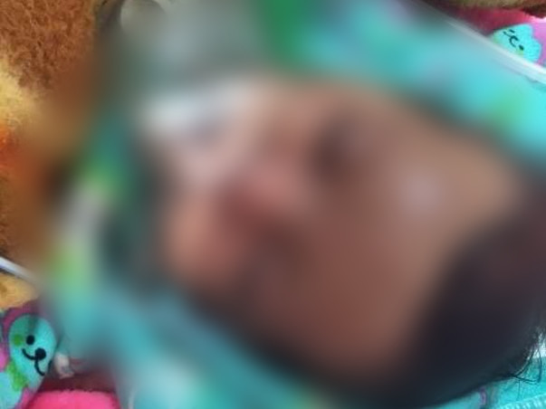 Help  my niece Baby Shivanshi Fight Cyanotic Congenital Heart Disease