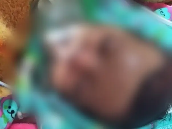Help  my niece Baby Shivanshi Fight Cyanotic Congenital Heart Disease