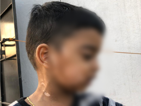 Help Nikhil Recover From Leucoderma