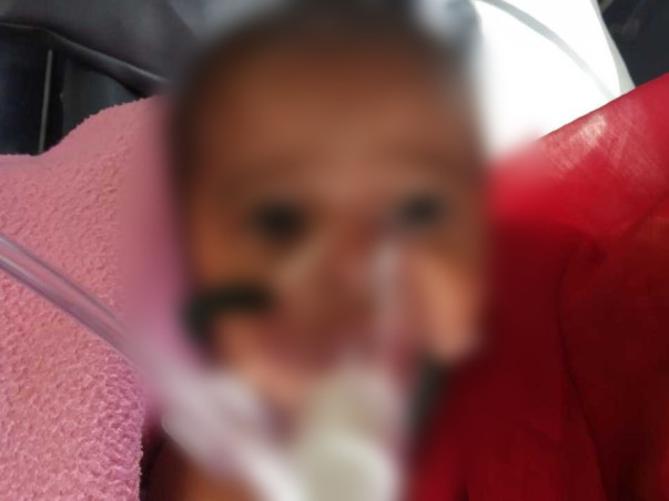 6 Months Old Parneeta  Needs Your Help To Recover From Aortic Stenosis