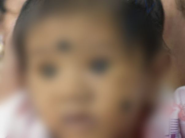 6 Months Old Baby Need Your Support Fighting From Liver Cirrhosis