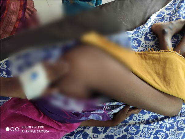 Help Indhumathi from the excruciating pain