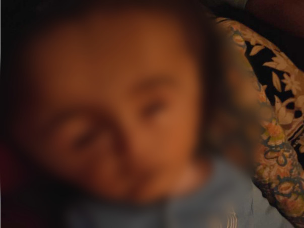 Without Immediate Surgery, This Baby May Never See, Walk, Sit Or Speak