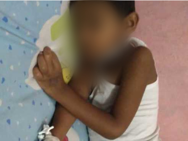 Support Rithwik Recover From Epilepsy