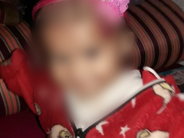 This Baby Girl Will Go Completely Blind Because Of Eye Cancer