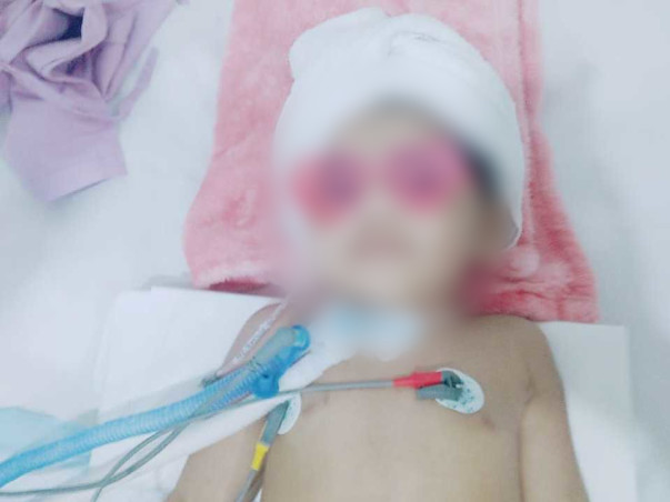 2 Years Old Siddhi Nagar Needs Your Help Fight Transverse Myelitis