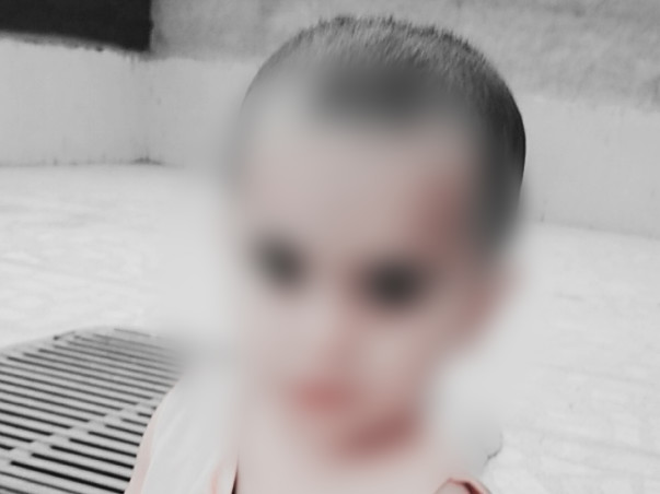 2 Years Old Siddhi Nagar Needs Your Help Fight Transverse Myelitis