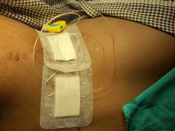 Help Indhumathi from the excruciating pain