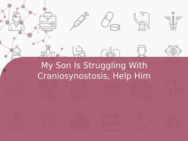 My Son Is Struggling With Craniosynostosis, Help Him