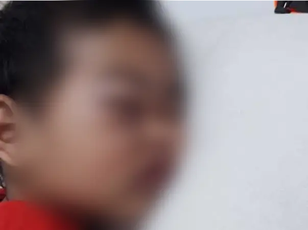 2 Years Old Ridip Karmakar Needs Your Help To Fight For Malignant Cancer