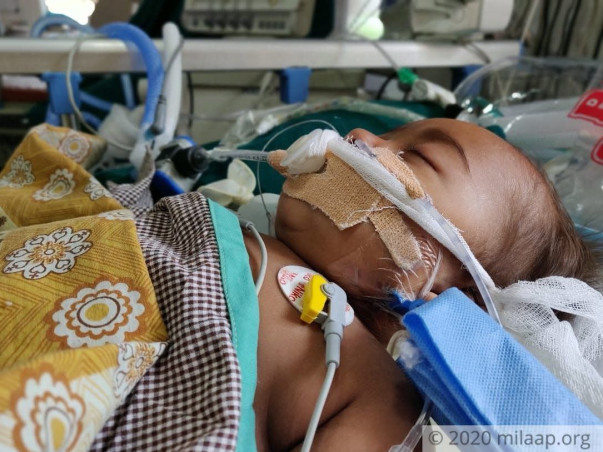 After A Month-Long Struggle, This Baby Can Only Go Home With Your Help