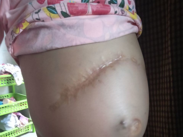 My Niece Is Struggling With Liver Failure, Help Her