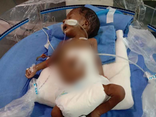 Support Baby Of LakshmiDevi Recover From Premature Birth Complications