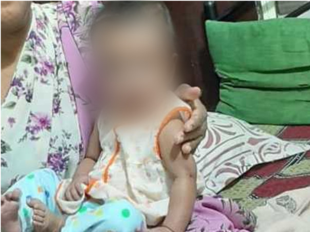 Support Naina Singh Recover From Tetralogy Of Fallot