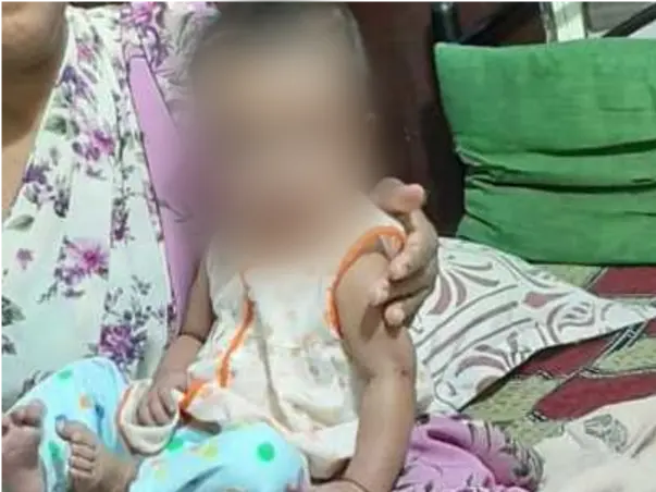 Support Naina Singh Recover From Tetralogy Of Fallot