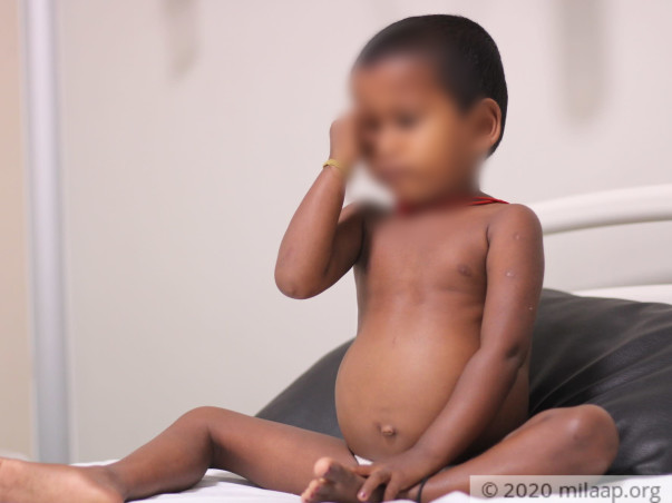 A Rare Genetic Disease Is Breaking This 3-Year-Old’s Bones