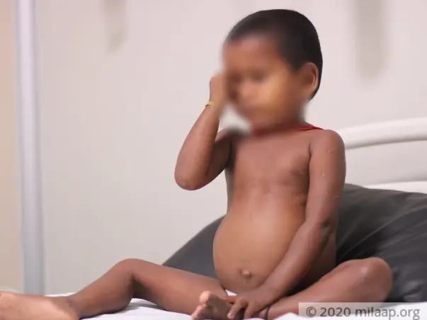 A Rare Genetic Disease Is Breaking This 3-Year-Old’s Bones