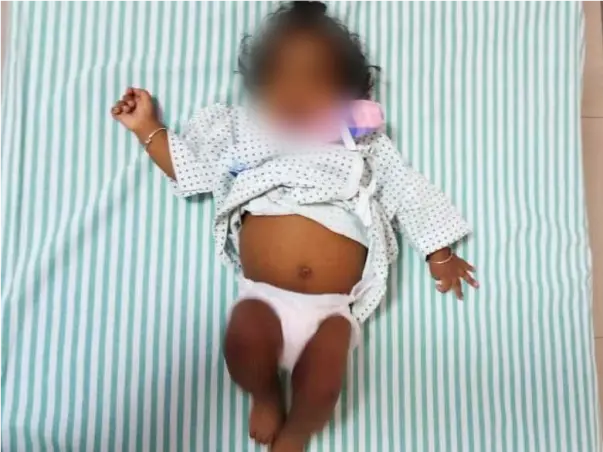 Support Vikranth Recover From Liver Cirrhosis