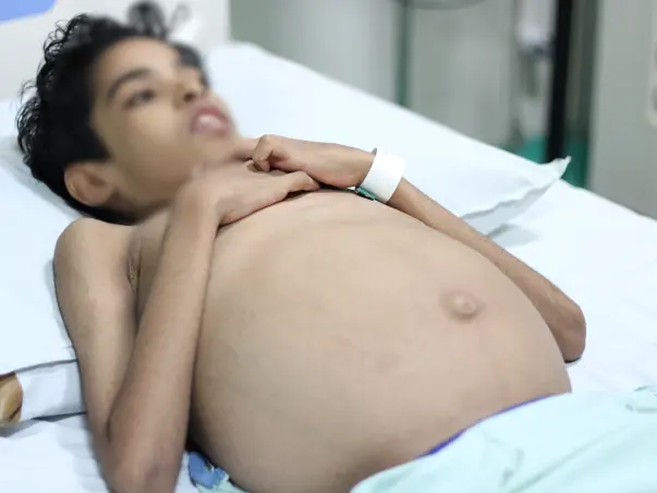 A Dangerous Liver Disease Has Reduced This Teenager To Just Bones