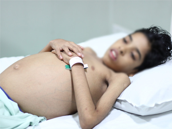 My brother needs a liver transplant and need your help