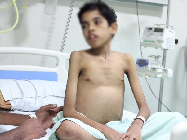 My brother needs a liver transplant and need your help