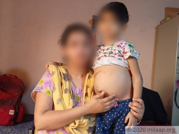 My Niece Is Struggling With Liver Failure, Help Her