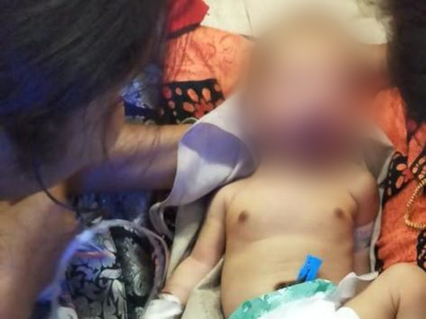 Please help the baby fighting with a hole in the heart