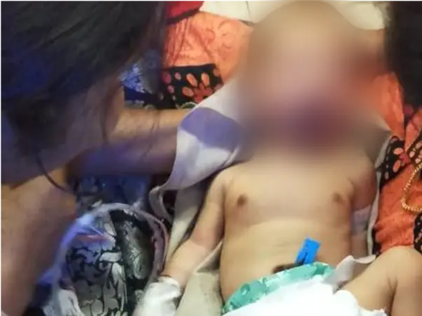 Please help the baby fighting with a hole in the heart