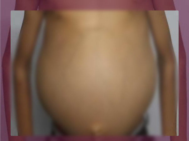 Help Dilliganesh for liver inflammation