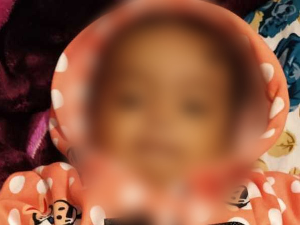 She Spent Her 1st Birthday In Pain Because Of A Dangerous Disease