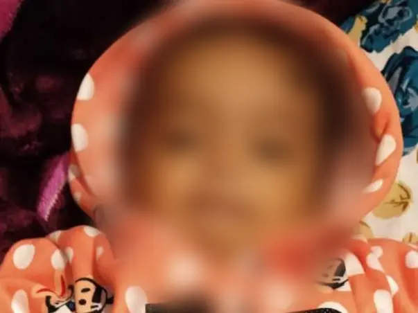 She Spent Her 1st Birthday In Pain Because Of A Dangerous Disease