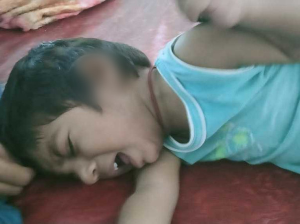 Support Manideep Recover From Brain Fungal Infection