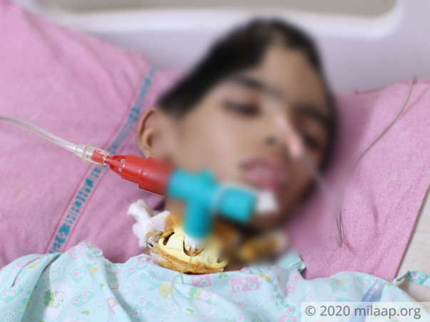 Half Of This 10-Year-Old's Skull Had To Be Removed Due To Rare Tumor