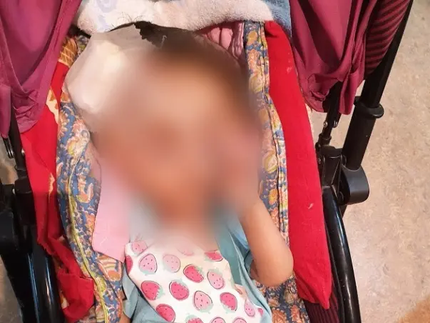 Without Immediate Surgery, This Baby May Never See, Walk, Sit Or Speak