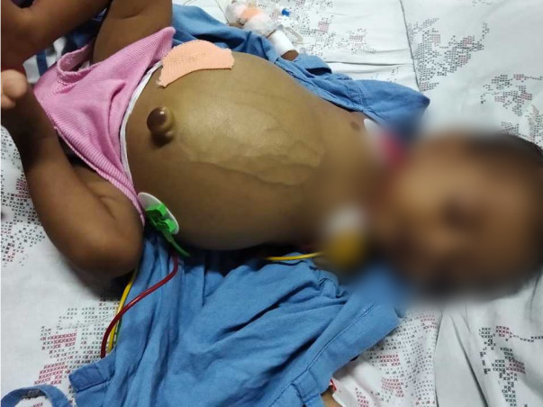 8 Months Old Yuvansh S/o Shiva Needs Help Fight Cholestatic Jaundice