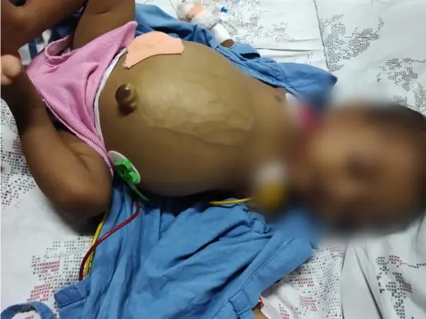8 Months Old Yuvansh S/o Shiva Needs Help Fight Cholestatic Jaundice