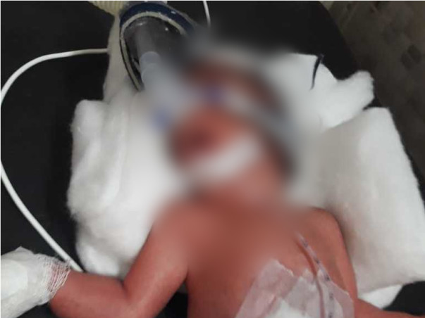 Save Life two new born