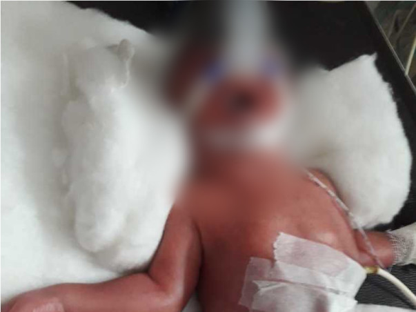 Save Life two new born