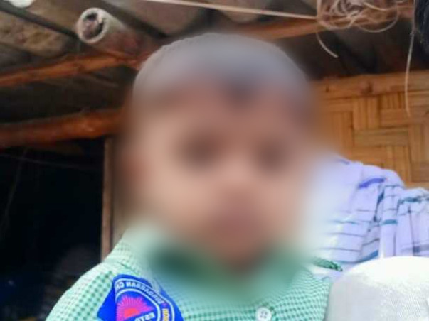 4 years old Misbaul  needs your help fight orbital cellutis