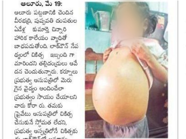 Support Harika Undergo Liver Transplant