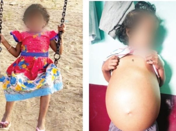 Support Harika Undergo Liver Transplant