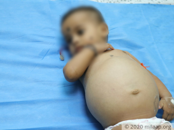 Even 12 Pills A Day Can't Keep This Baby Alive Anymore, She Needs Help