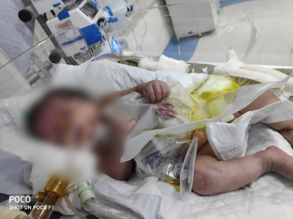 "Baby of Heena" Is Born Preterm With Respiratory Distress Syndrome,Help Her