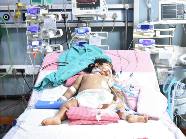 9 months old ANJANEYA DEVANSH fight Chronic lung disease, Sepsis-septic shock, Acute Kidney Injury, Acute Liver Injury, DIC, Cardiac arrhythmia